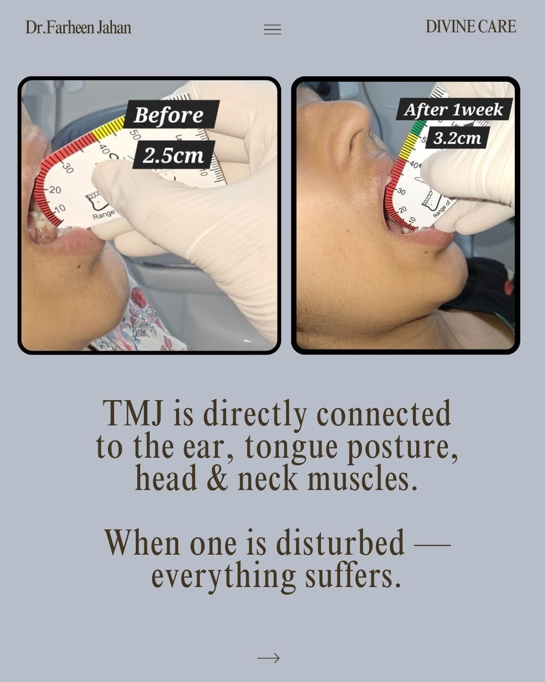 Treatment result